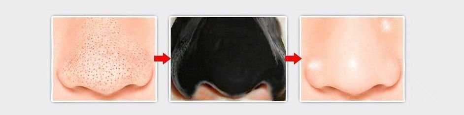 Black Mask 10 минут и никаких черных точек на лице! для лица СКИДКА