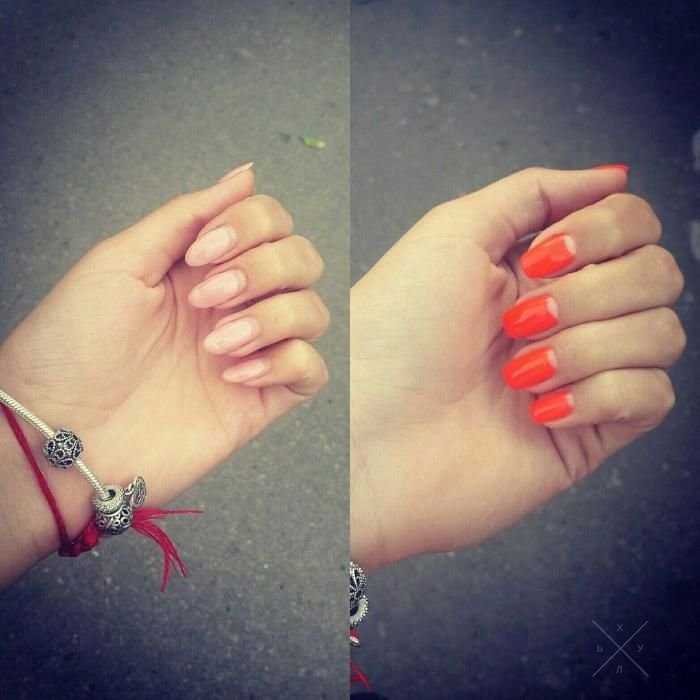 Скидка 40% на любую процедуру